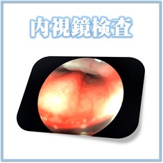 内視鏡検査